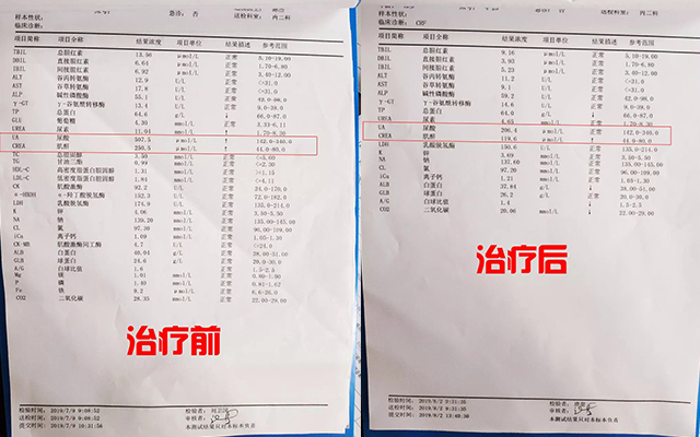 肾衰竭肌酐反复升高是怎么回事？